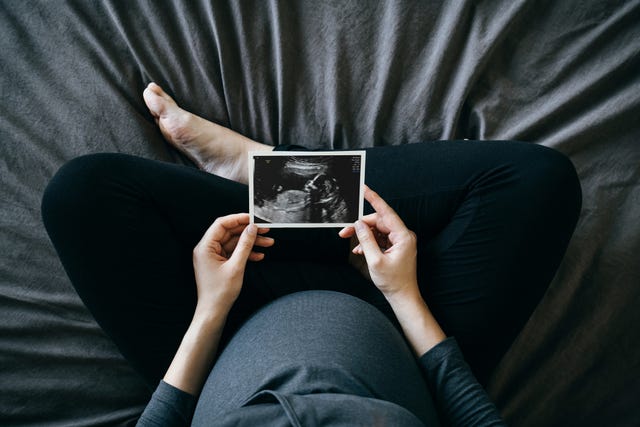 pregnant woman holding an ultrasound scan photo in front of her baby bump, sitting on bed at home